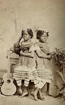 The_Millie-Christine_sisters,_conjoined_twins,_standing._Pho_Wellcome_V0029576